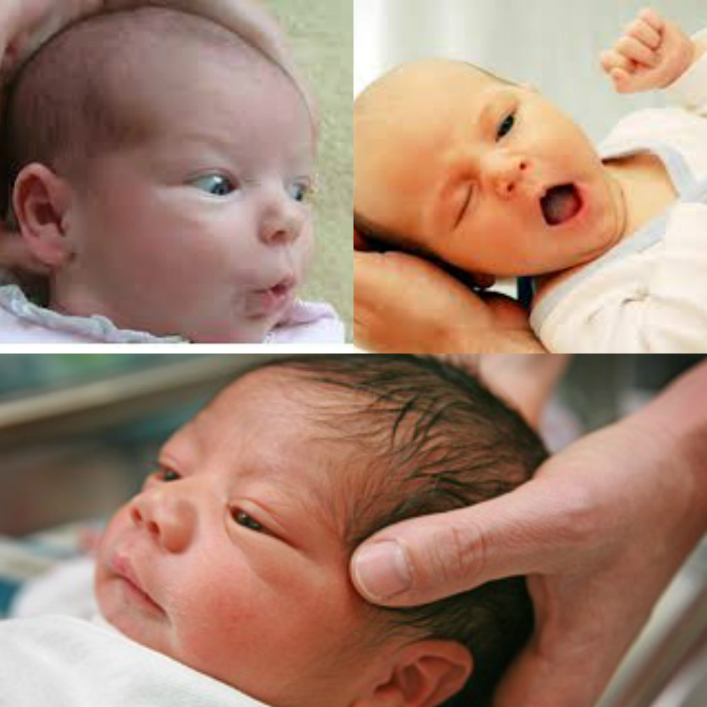 Новорожденный стресс. Перинатальная энцелофапатия. Перинатальная энцефалопатия. Энцефалопатия у новорожденных. Перинатальная энцефалопатия у новорожденных.